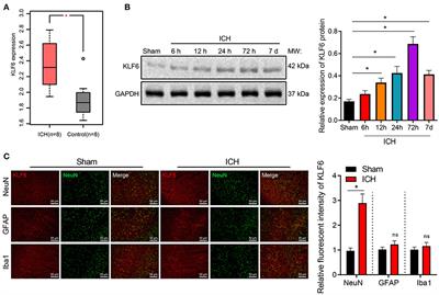 Krüppel-Like Factor 6 Silencing Prevents Oxidative Stress and Neurological Dysfunction Following Intracerebral Hemorrhage via Sirtuin 5/Nrf2/HO-1 Axis